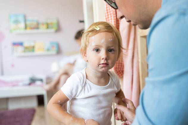 Little girl with chickenpox, unrecognizable father dressing her. Little two year old girl at home sick with chickenpox, white antiseptic cream applied by her mother to the rash. Unrecognizable father dressing her. model released Copyright: xx Kiahnikova_151