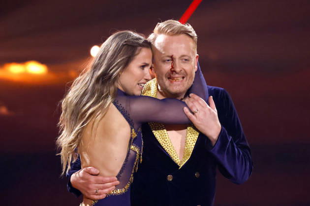 Entertainer Ross Antony und Profitänzerin Mariia Maksina bei der sechsten Tanzshow der 19. Staffel der RTL-Tanzshow Lets Dance im Coloneum. Ross Antony läuft das Blut übers Gesicht, nachdem er sich beim tanzen eine blutende Wunde zugezogen hat. Köln, 17.04.2026 NRW Deutschland Copyright: xChristophxHardtx