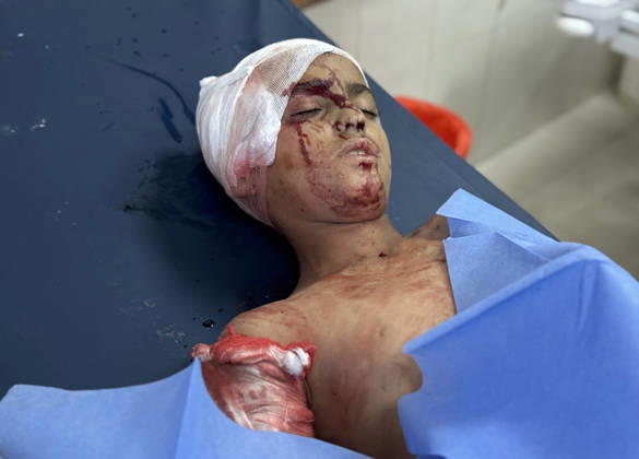 Israeli attacks on Gaza continue despite ceasefire agreement KHAN YUNIS, GAZAI PALESTINE - MAY 25: (EDITOR S NOTE: Image depicts graphic content) Palestinian children are taken to Nasser Hospital for medical treatment following the Israeli attack on tents housing displaced people in the al-Mawasi area despite the ceasefire agreement in Khan Yunis, Gaza, Palestine on May 25, 2026. A six-year-old child and a woman were killed and 20 people, most of them children and women, were injured in an attack. Abdallah F.s. Alattar Anadolu Khan Yunis Gaza. Editorial use only. Please get in touch for any other usage.  Copyright: x2026xAnadoluxAbdallahxF.s.xAlattarx