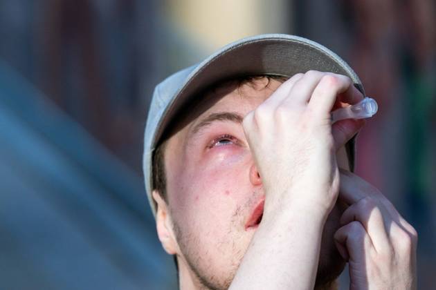 A youth treats his eyes with sterile water after being hit with teargas as students gather outside several schools in Liege during a protest against education reforms and budget cuts, on Tuesday 6 October 2026. Yesterday police arrested 16 people after the protests turned violent. The protests in French-speaking Belgium have been ongoing for months, following a series of reforms and budget cuts introduced by the French Community Government.  JONASxROOSENS 188939287