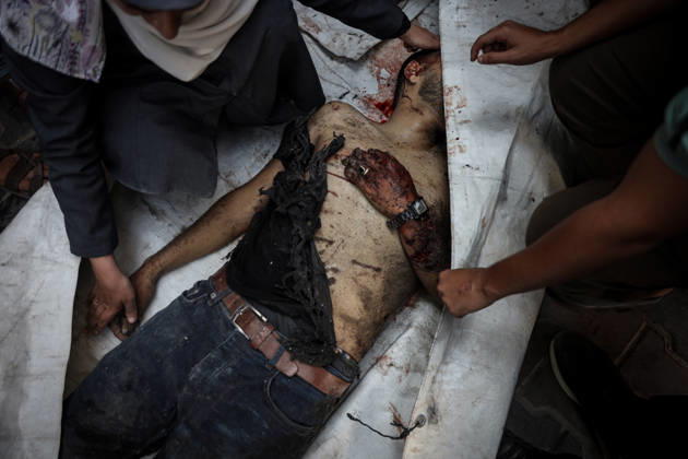 Israeli attacks continue on Gaza GAZA, PALESTINE - OCTOBER 10 : (EDITORS NOTE: Image depicts death) Palestinian deceased bodies who lost their lives after an Israeli airstrikes are brought to Al-Shifa Hospital in Gaza City, Palestine on October 10, 2026. Abdalhkem Abu Riash Anadolu Gaza City Gaza. Editorial use only. Please get in touch for any other usage.  Copyright: x2026xAnadoluxAbdalhkemxAbuxRiashx