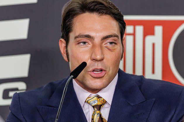 11.10.2026. Essen. Fabio Knez bei der Pressekonferenz zum Fame Fighting 4 Promiboxen. Essen Atlantic Hotel Nordrhein-Westfalen Deutschland