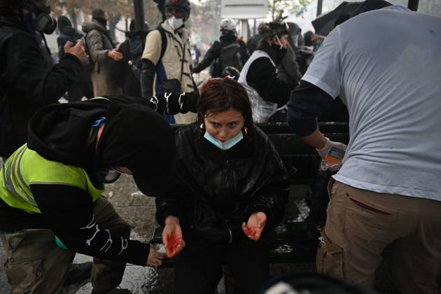 Police intervene in demonstrators amid ongoing protests in Paris PARIS, FRANCE - OCTOBER 24: (EDITOR S NOTE: Image depicts graphic content) A protester gets injured as demonstrators carrying banners, gather during a demonstration amid ongoing social and political tensions in Paris, France, on October 24, 2026. Mouneb Taim Anadolu Paris France. Editorial use only. Please get in touch for any other usage.  Copyright: x2026xAnadoluxMounebxTaimx