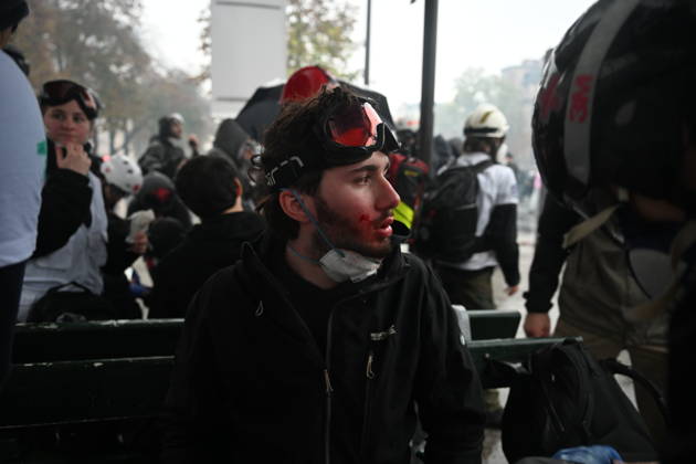 Police intervene in demonstrators amid ongoing protests in Paris PARIS, FRANCE - OCTOBER 24: (EDITOR S NOTE: Image depicts graphic content) A protester gets injured as demonstrators carrying banners, gather during a demonstration amid ongoing social and political tensions in Paris, France, on October 24, 2026. Mouneb Taim Anadolu Paris France. Editorial use only. Please get in touch for any other usage.  Copyright: x2026xAnadoluxMounebxTaimx