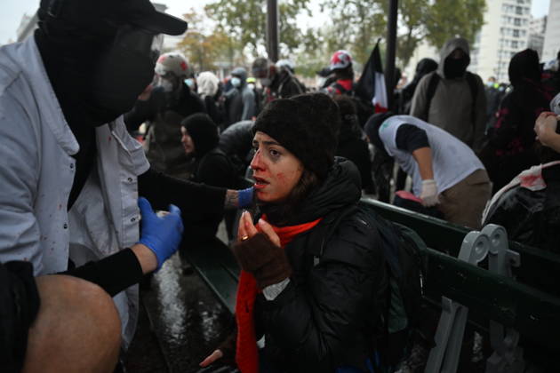 Police intervene in demonstrators amid ongoing protests in Paris PARIS, FRANCE - OCTOBER 24: (EDITOR S NOTE: Image depicts graphic content) A protester gets injured as demonstrators carrying banners, gather during a demonstration amid ongoing social and political tensions in Paris, France, on October 24, 2026. Mouneb Taim Anadolu Paris France. Editorial use only. Please get in touch for any other usage.  Copyright: x2026xAnadoluxMounebxTaimx